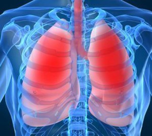 tubercloza-pulmonara